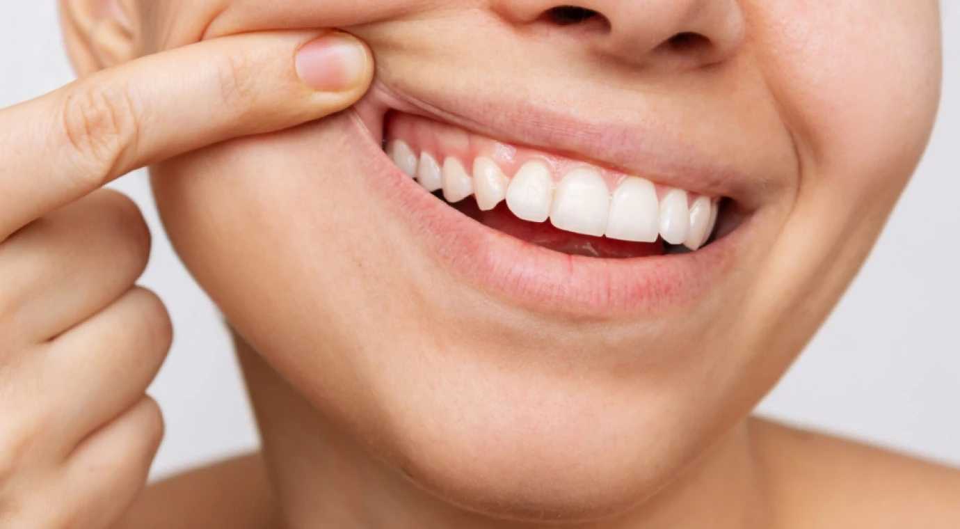 Dentistes Lyon 8 : santé de vos gencives