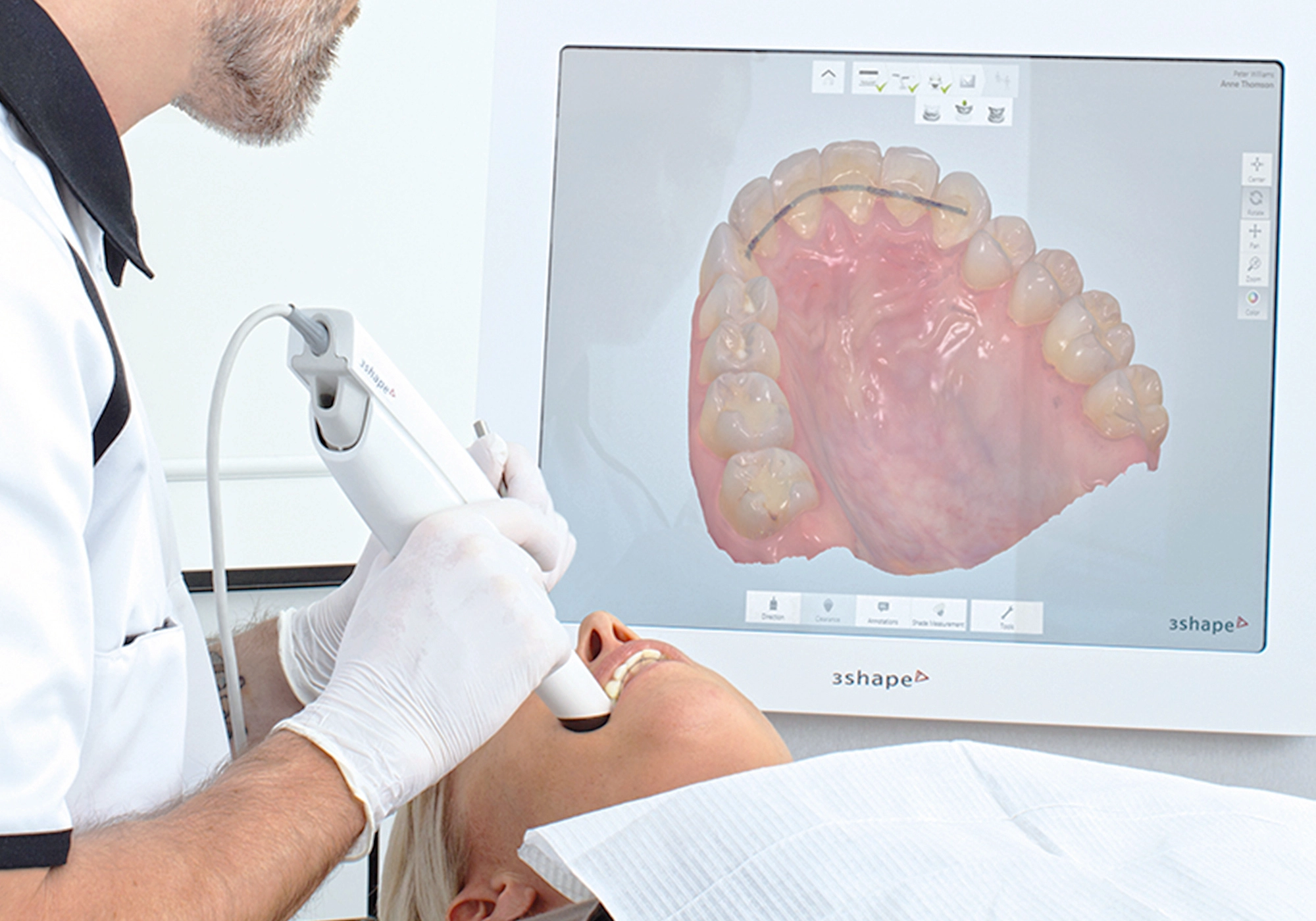 Greffe des gencives : dentistes à Lyon au Cabinet Grange Blanche