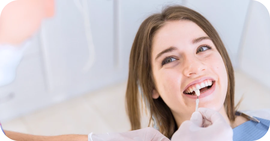 Facettes en céramique à Lyon 8