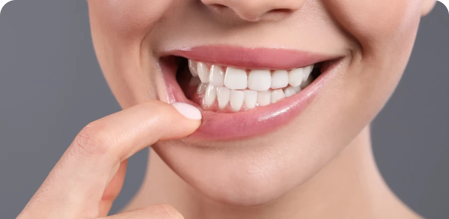 Récessions gingivales, soins dentaires à Lyon 8, santé de vos gencives