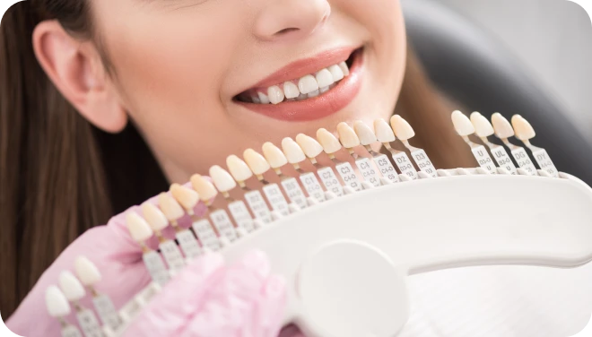 Facettes dentaires à Lyon 8, dentisterie, esthétique du sourire